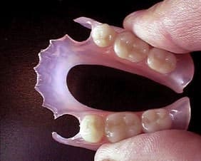 Precios prótesis dentales removibles sin ganchos