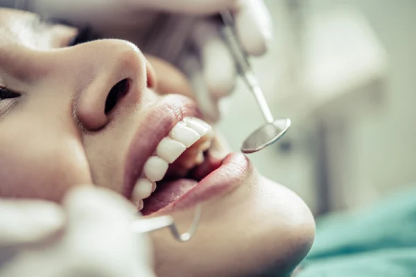 ¿Se puede salvar un diente con periodontitis? ¿Se puede salvar un diente con periodontitis?