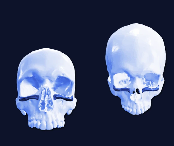Implantes infraorbitarios en Face Clinic