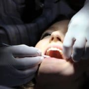 Alargamiento de corona dental tratamiento