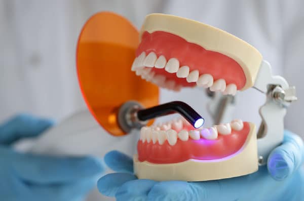 Cirugía periodontal precio