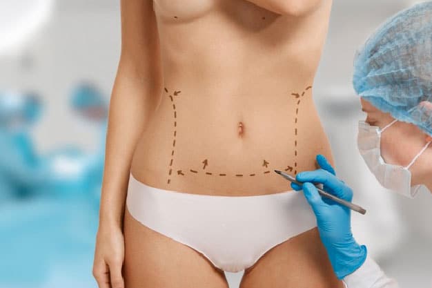 Tratamientos de Cirugia plastica y estetica corporal