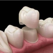 Clinicas de estetica dental
