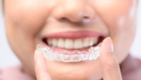 ¿Cubren los seguros dentales Invisalign?