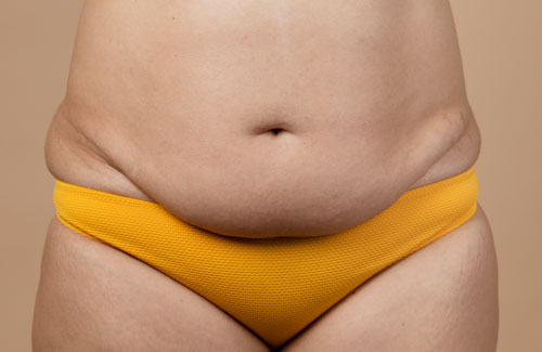 Eliminar grasa abdominal en mujeres