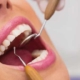 Esmalte dental