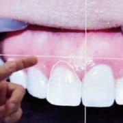 Estética dental digital