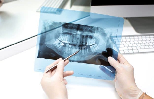 Radiografía dental