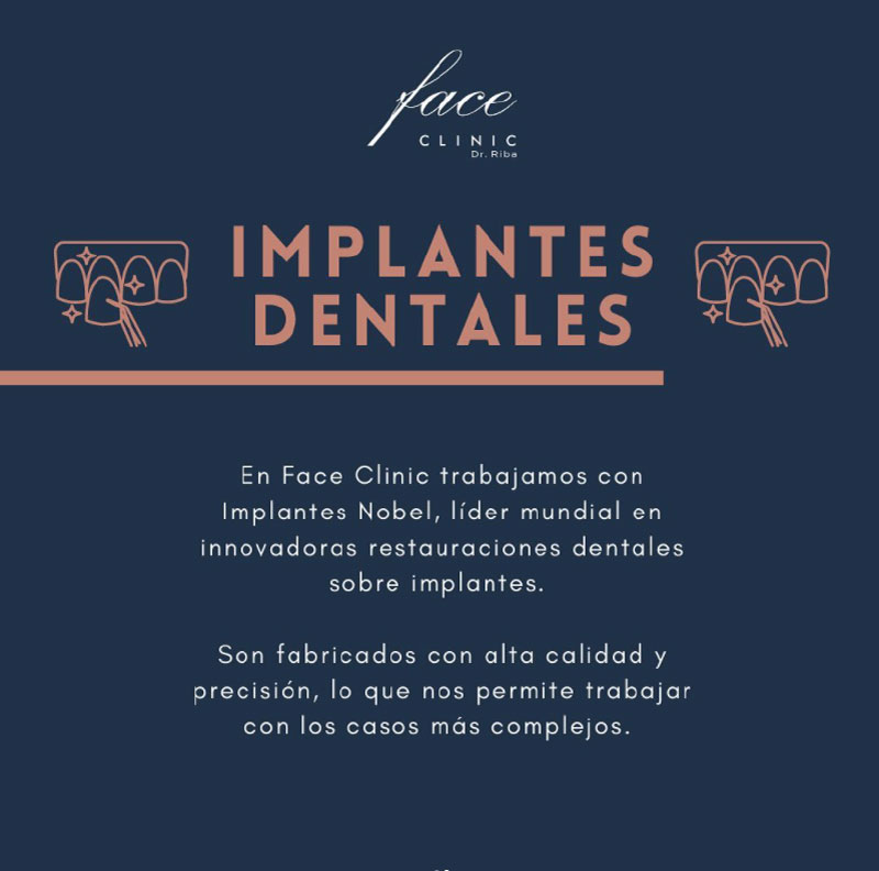 Implantes dentales marcas
