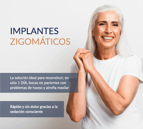 Implantes cigomáticos postoperatorio