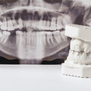 Osteotomía dental Y MANDIBULAR