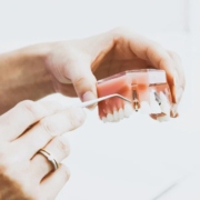 implantes dentales postoperatorio