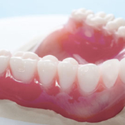 Prótesis dentales Huelva precios