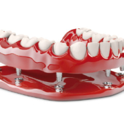 Prótesis dentales Pozuelo y Aravaca