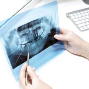 Radiología dental en Madrid