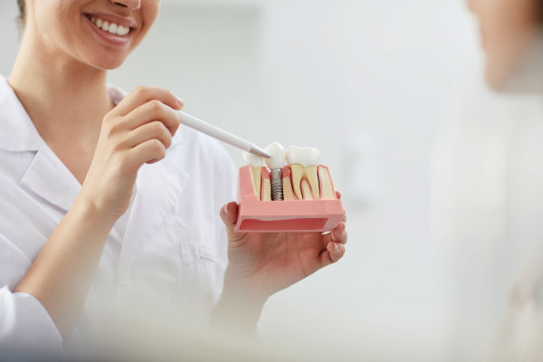 Tratamientos dentales innovadores 2021